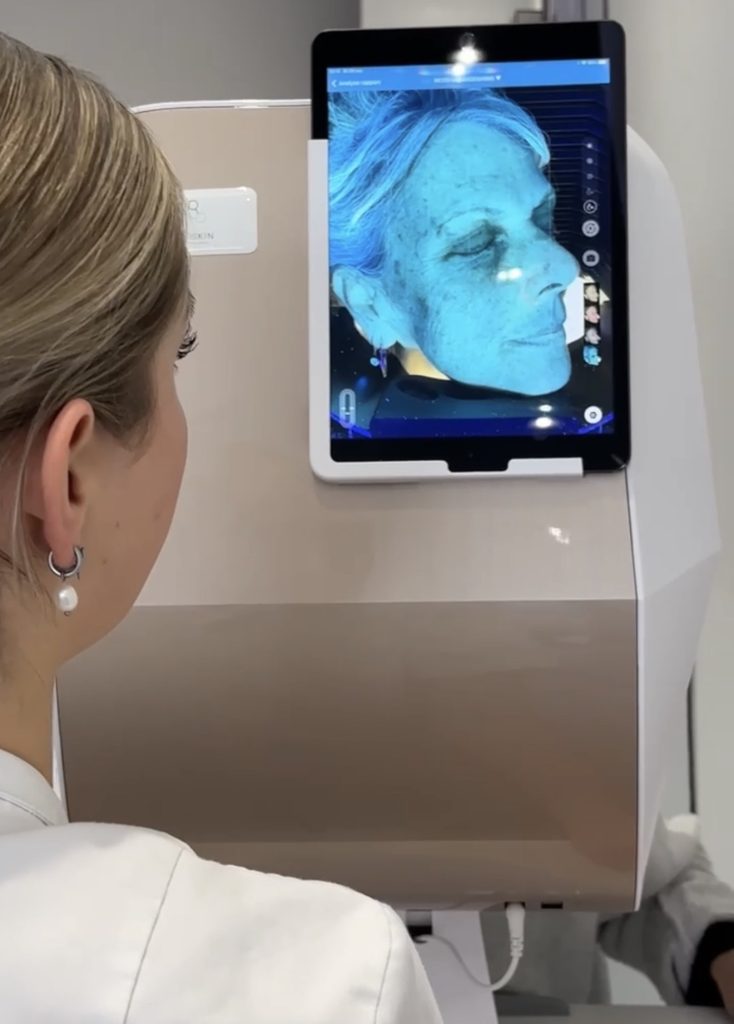 Huidscan analyse bij Sophie Skincare in Voorburg en omgeving Den Haag