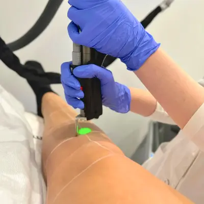 Laserontharen van de benen bij Sophie Skincare in Voorburg