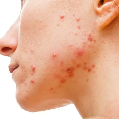 Huidbehandeling in de huidkliniek van Sophie Skincare in Voorburg