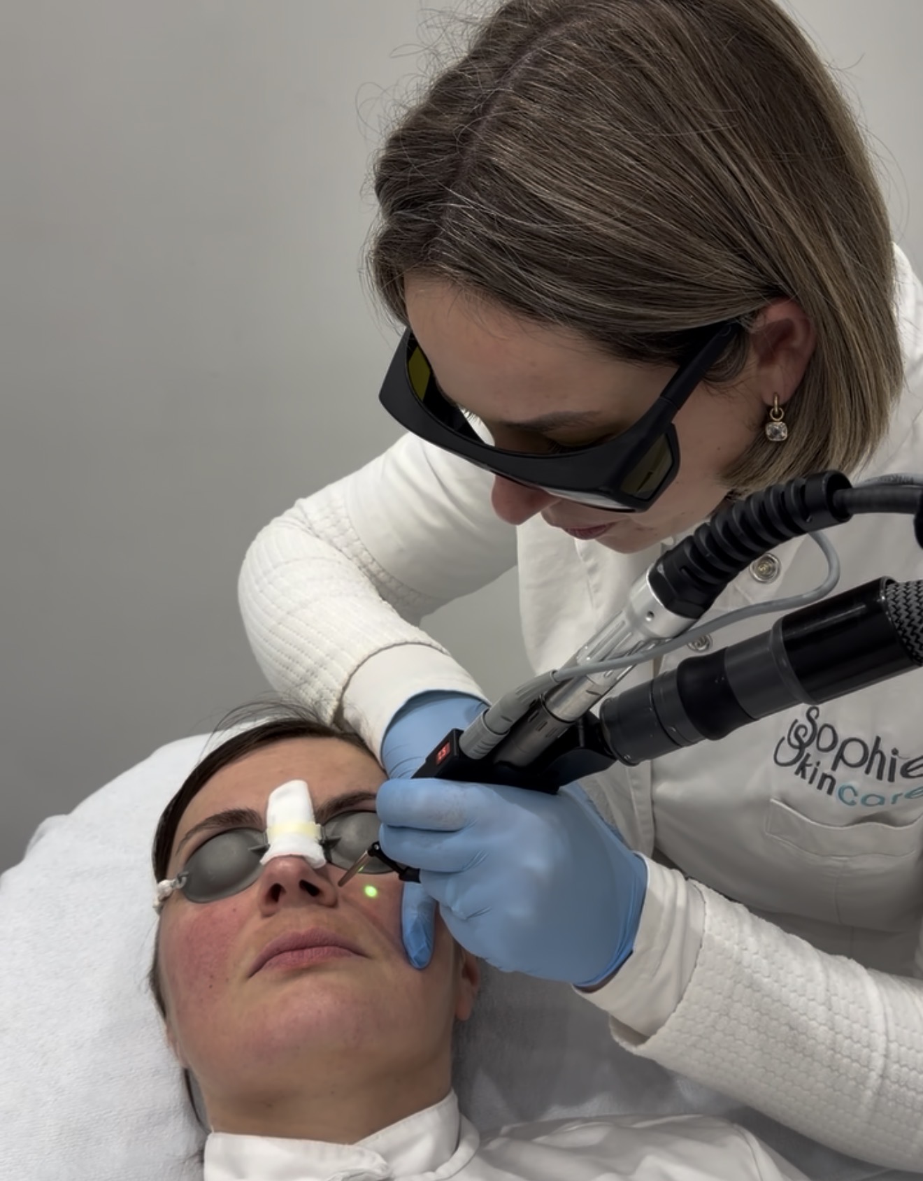 Huidtherapeut van Sophie Skincare behandelt zichtbare vaatjes in het gezicht met de vaatlaser