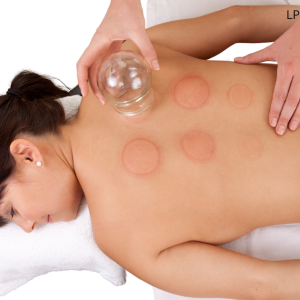 Cupping bij Sophie Skincare in Voorburg