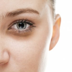 Carboxy therapie donkere kringen Den Haag- Voorburg bij Sophie Skincare