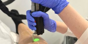 laser ontharen benen in Den Haag Sophie Skincare Huidtherapie