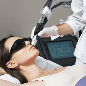laser ontharen resultaat