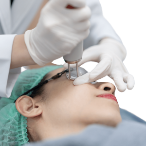 Pigmentvlekken weg laten laseren bij huidkliniek Sophie Skincare in Voorburg