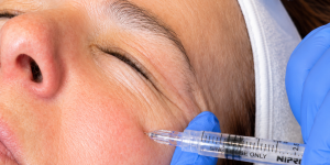 Skinboosters