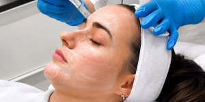 Dermapen/ Microneedling