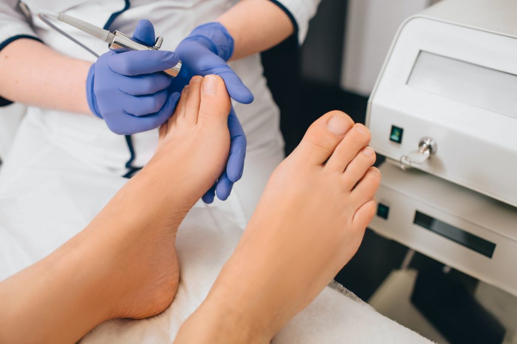 Schimmelnagel laserbehandeling bij Sophie Skincare in Voorburg en Den Haag