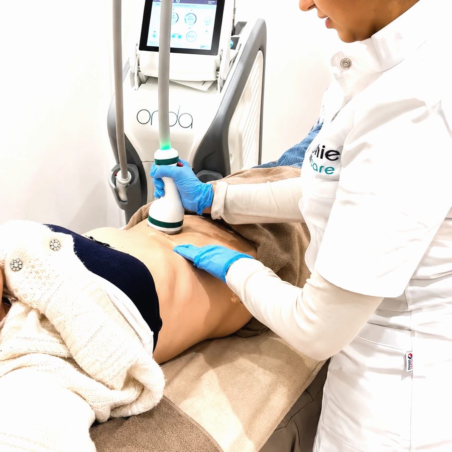 Bodyshape-specialist behandelt de buik met Deka Onda Coolwaves